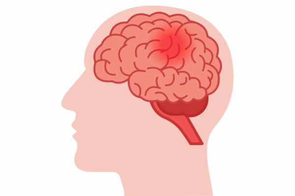 Kerala on alert after rare brain‑eating amoeba cases in Kozhikode