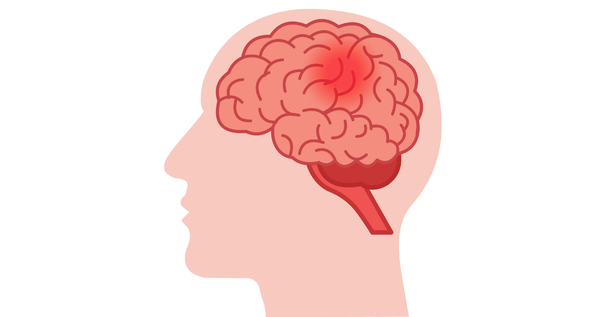 Kerala on alert after rare brain‑eating amoeba cases in Kozhikode